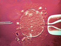 prostatite lombalgia medscape
